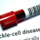 sickle cell